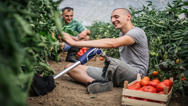 Man with prosthetic leg